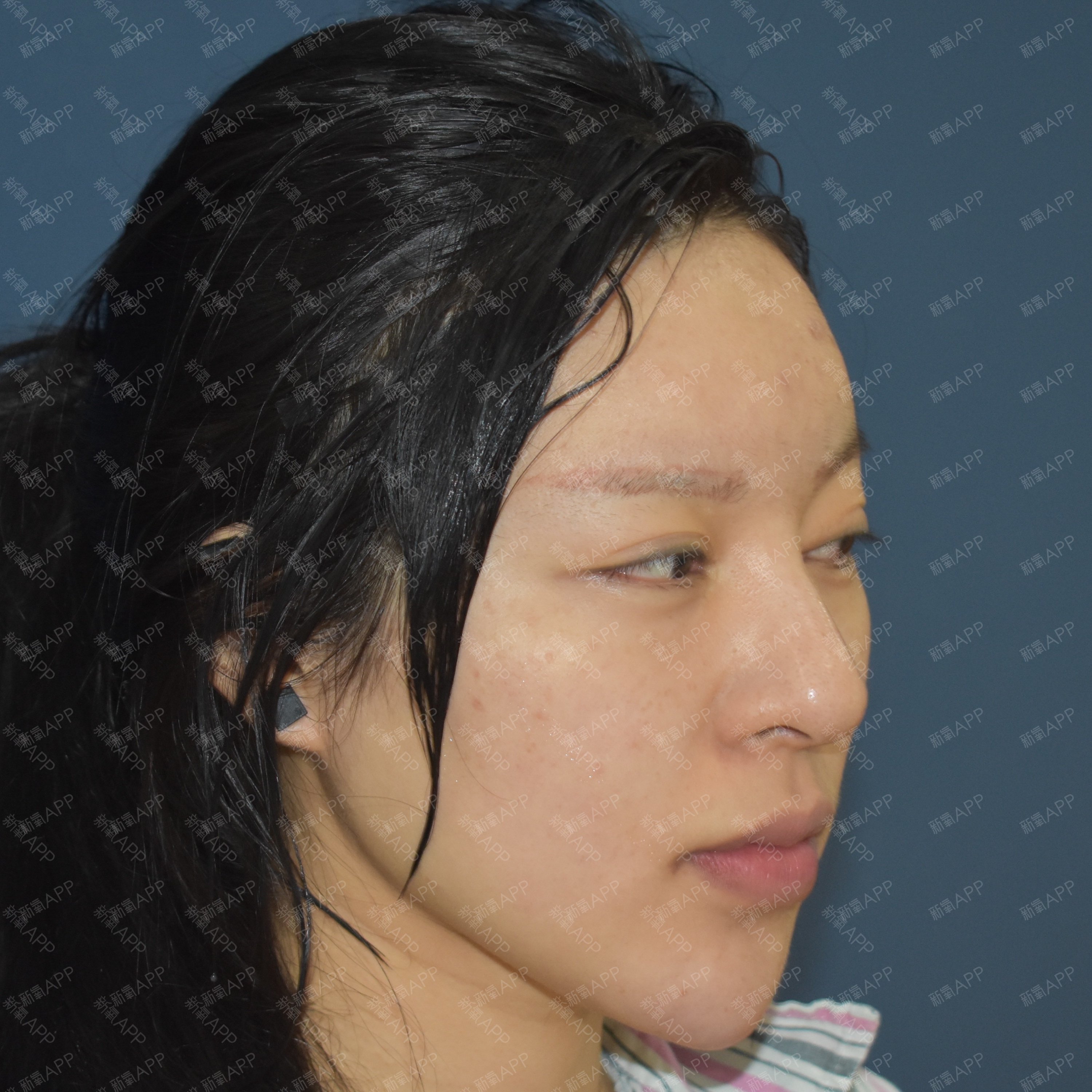 供卵试管婴儿双胞胎产检的区别是什么？供卵试管婴儿产检有哪些...