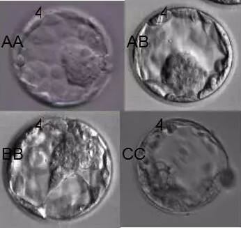 供卵试管婴儿是直接移植到子宫腔吗-供卵试管婴儿中如何将胚胎移植到子宫内