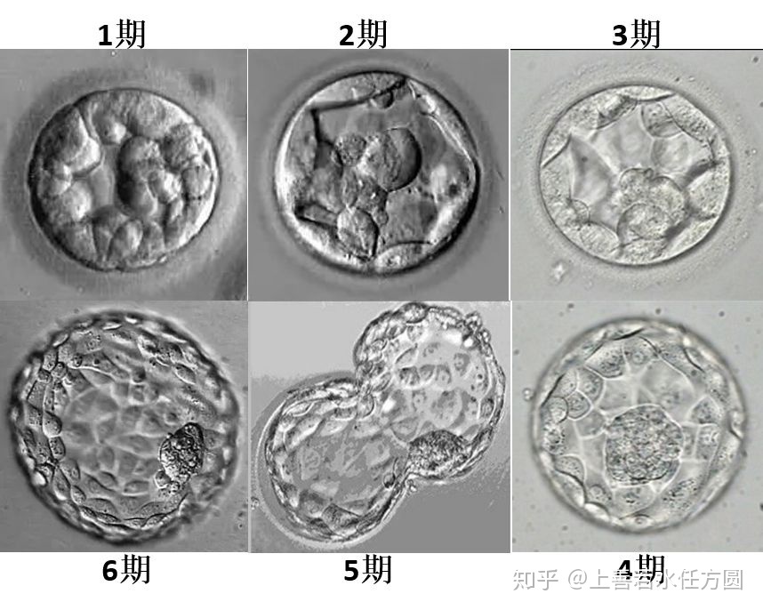 事实证明，这样吃可以提高赠卵试管婴儿的成功率!我了解到