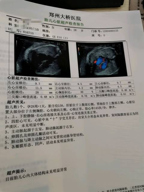借卵试管代怀公司移植后是否检查孕酮借卵试管代怀公司移植后是否检查孕，4天后的正常孕酮水平是多少？