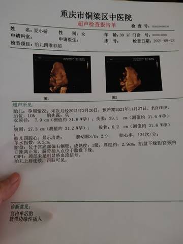 如何在人工授精和赠卵做借卵试管代生之间做出选择。］人工授精