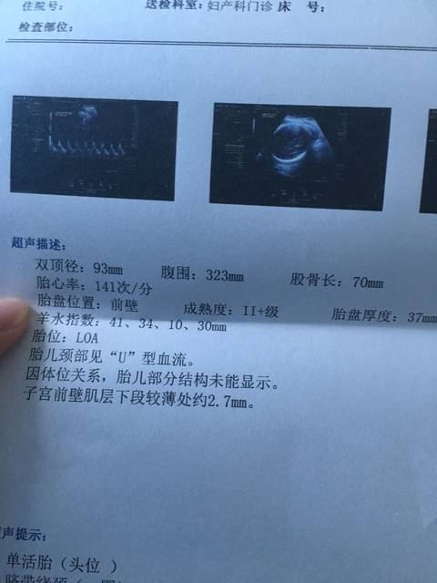 37岁大龄女性卵子质量就不好了吗