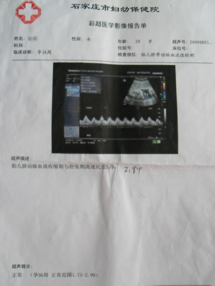 第一次在济南借卵做试管移植成功后减药顺序是什么