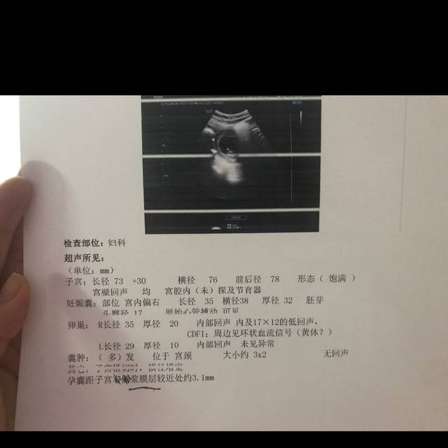 第三代供卵试管必须养囊吗