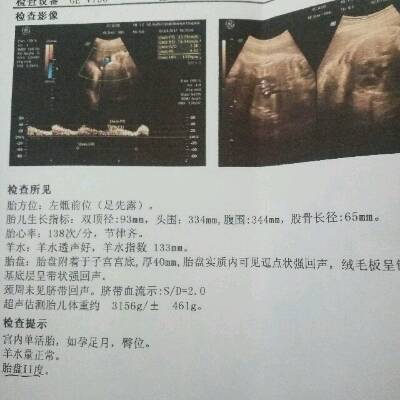私立医院做借卵试管婴儿多少钱