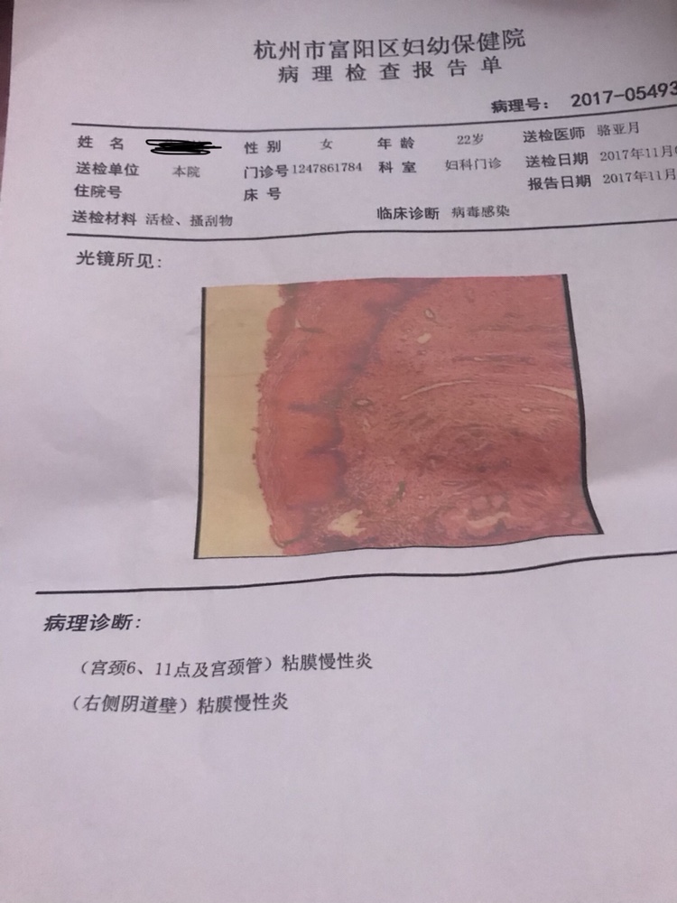 试管胚胎2是什么意思