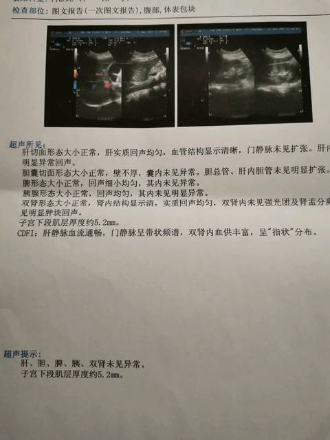 精子检测怎么看结果（精子检查报告该怎么看）