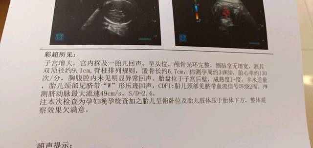 精子检测怎么看结果（精子检查报告该怎么看）